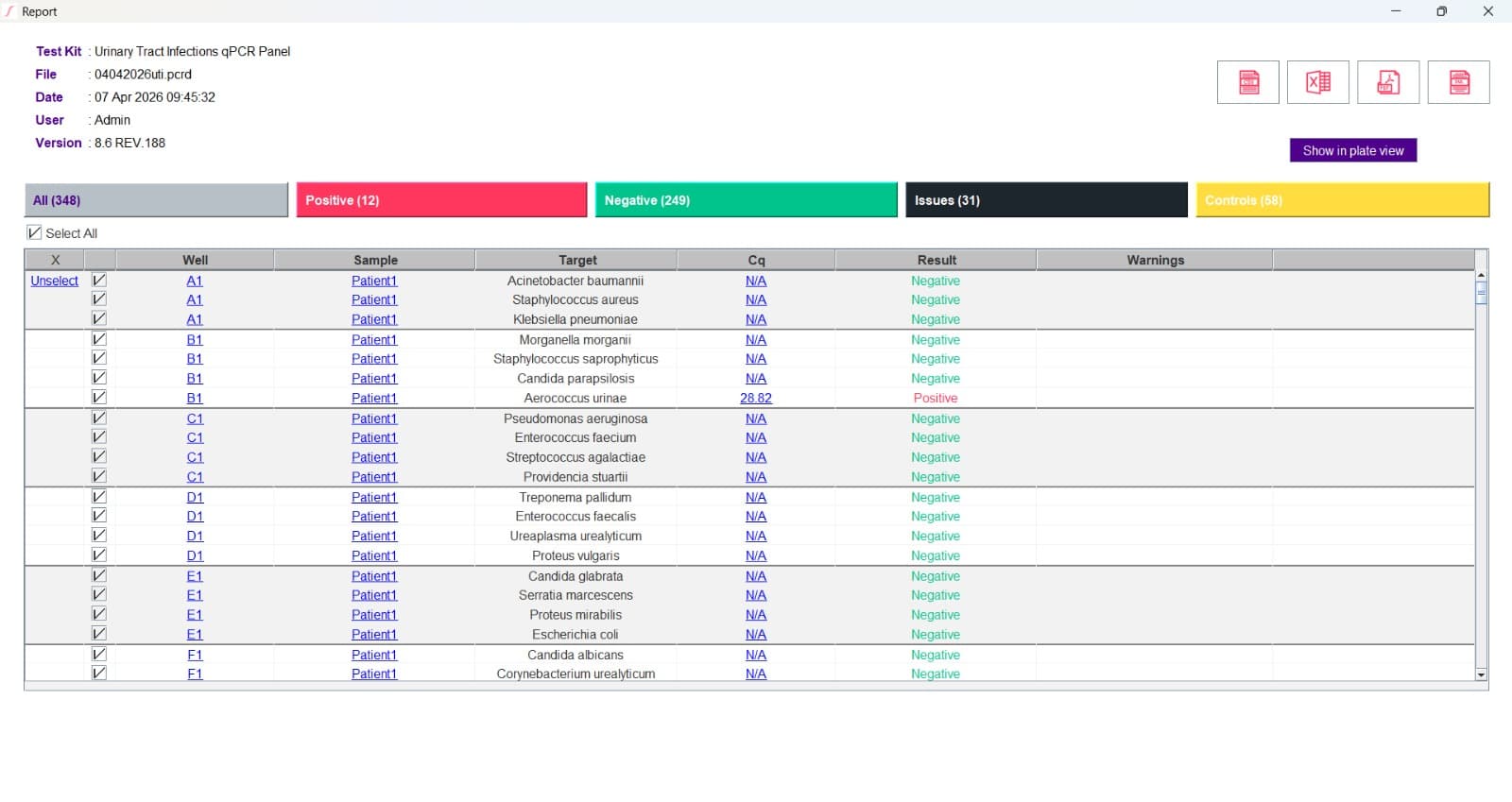 Sigmoida report view